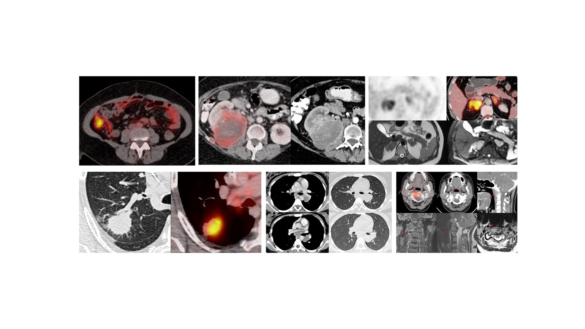 The 6 Cases for YouTube Live on 26 Feb at 7 PM Indian Standard Time