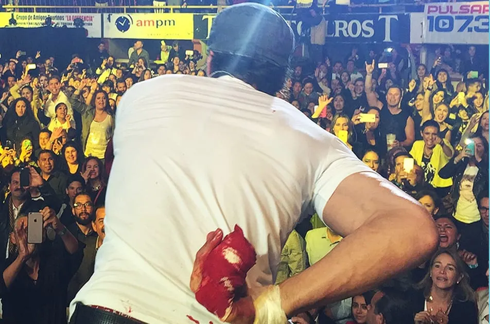 5 Times Musicians Played Through Epic On-Stage Injuries