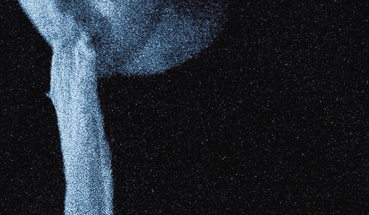 "I Wanted, So Badly, To See His Face"