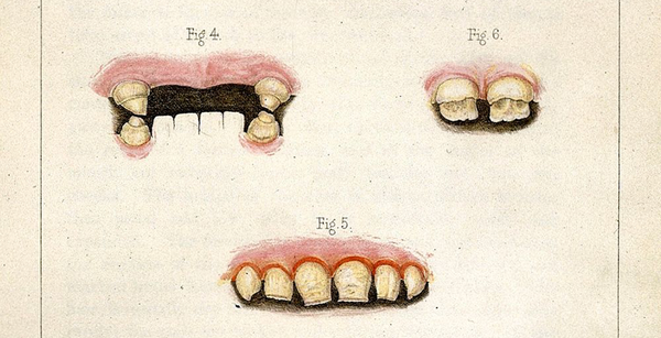 The art of the second opinion
