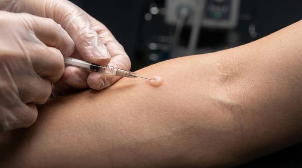 ТВГІ замість Манту: в Україні стартує перехід на сучасну діагностику туберкульозу