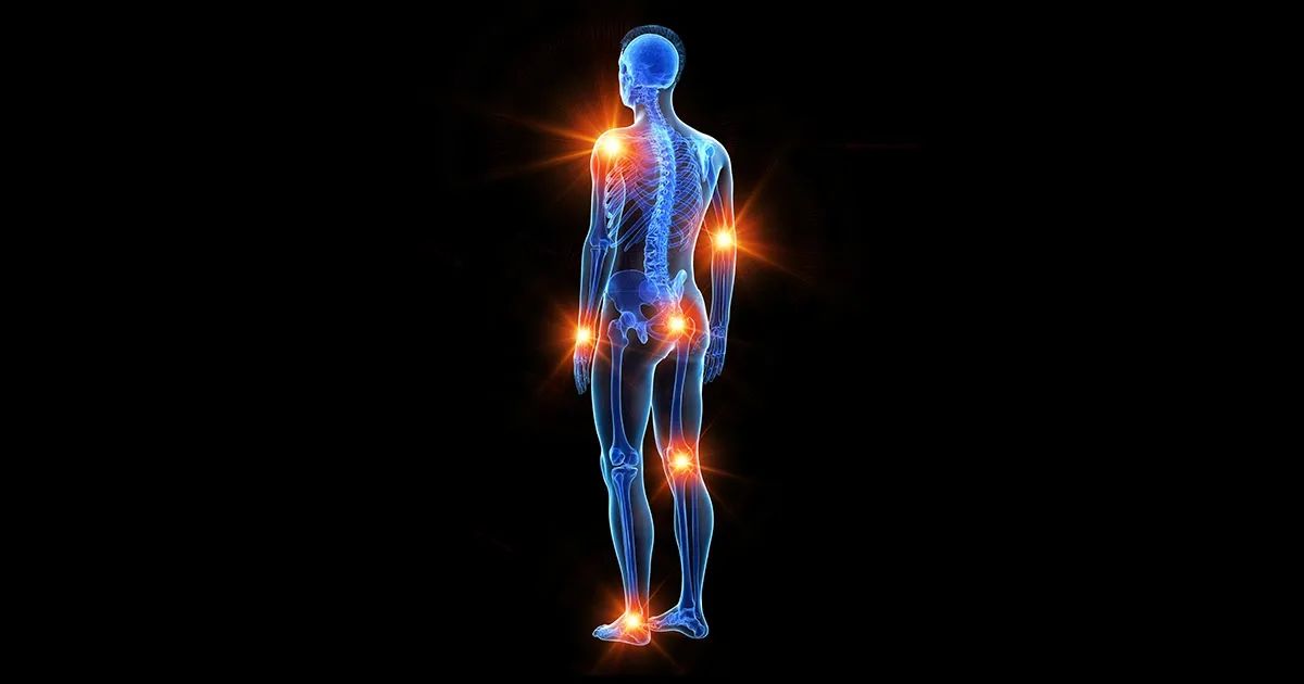 Pourquoi certains muscles déclenchent des douleurs sans raison apparente
