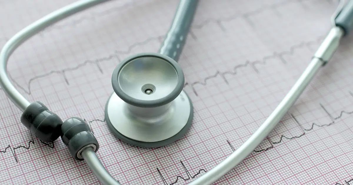 Comment identifier la fibrillation atriale et ce qui peut aider