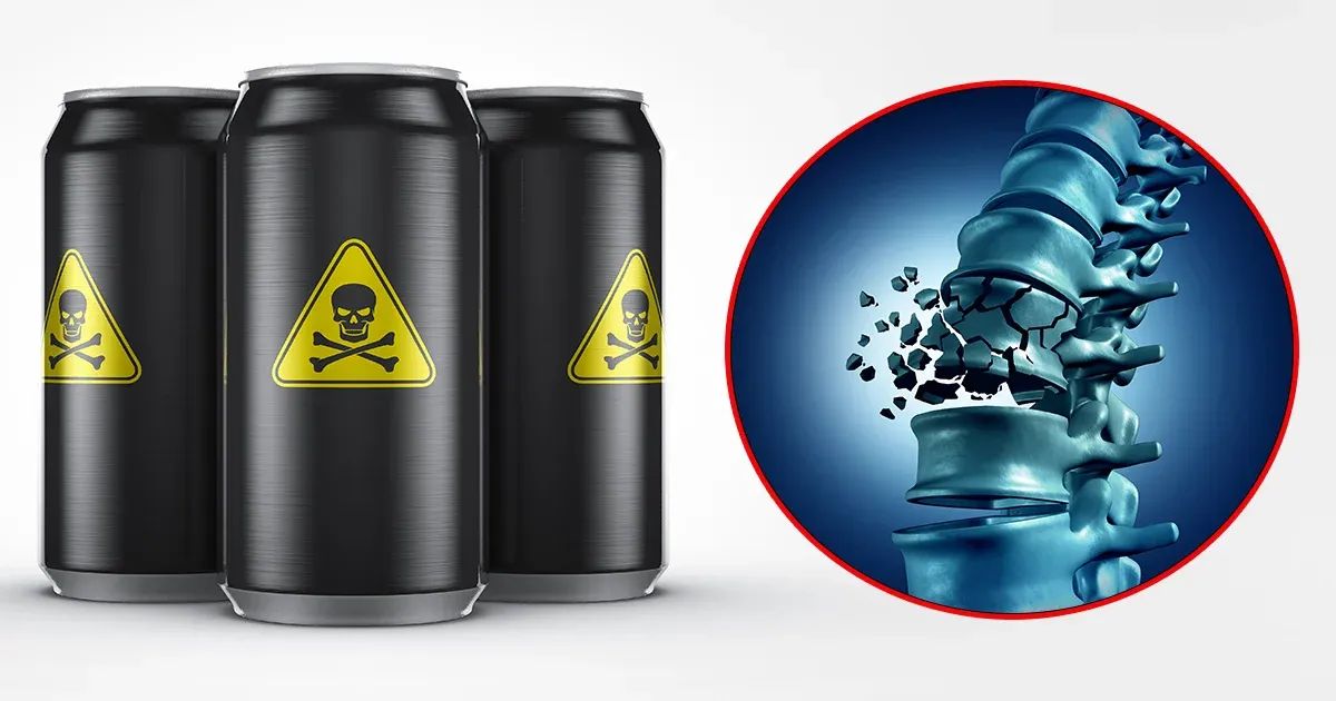 Santé osseuse en péril : ces boissons populaires perturbent vos minéraux