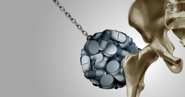 Les médicaments populaires contre les brûlures d'estomac ont un lien avec l'ostéoporose