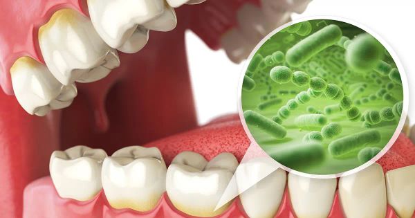 Prenez soin de votre bouche pour protéger votre cerveau