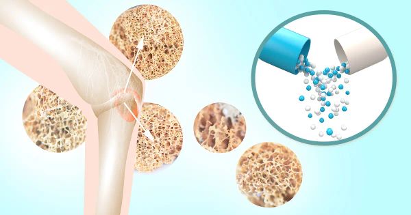 La fragilité de vos os pourrait être inversée grâce à cette vitamine