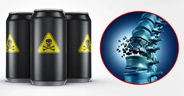 Santé osseuse en péril : ces boissons populaires perturbent vos minéraux