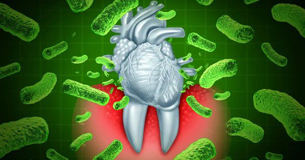 Des gencives en mauvais état pourraient être à l’origine de vos douleurs persistantes