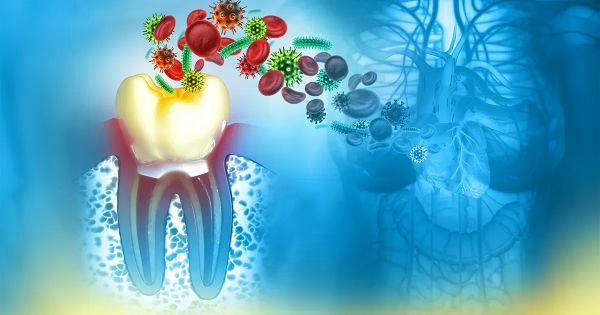Ce problème dentaire sous-estimé augmente votre risque d’arythmie