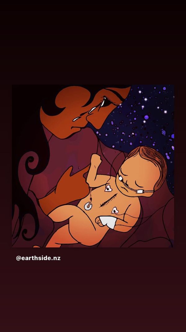 FNC - When it rains, it pours