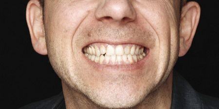 Image of: How Do I Get Over My A**hole Ex?