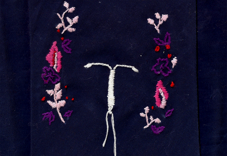 Image of: My Body Hates My IUD — But It Was Still Worth It