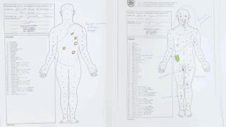Autopsy records detail brutal attack at center of Brent Sikkema case in Brazil