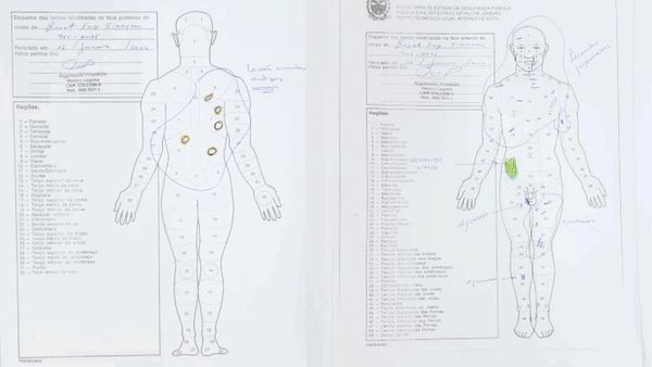 Autopsy records detail brutal attack at center of Brent Sikkema case in Brazil