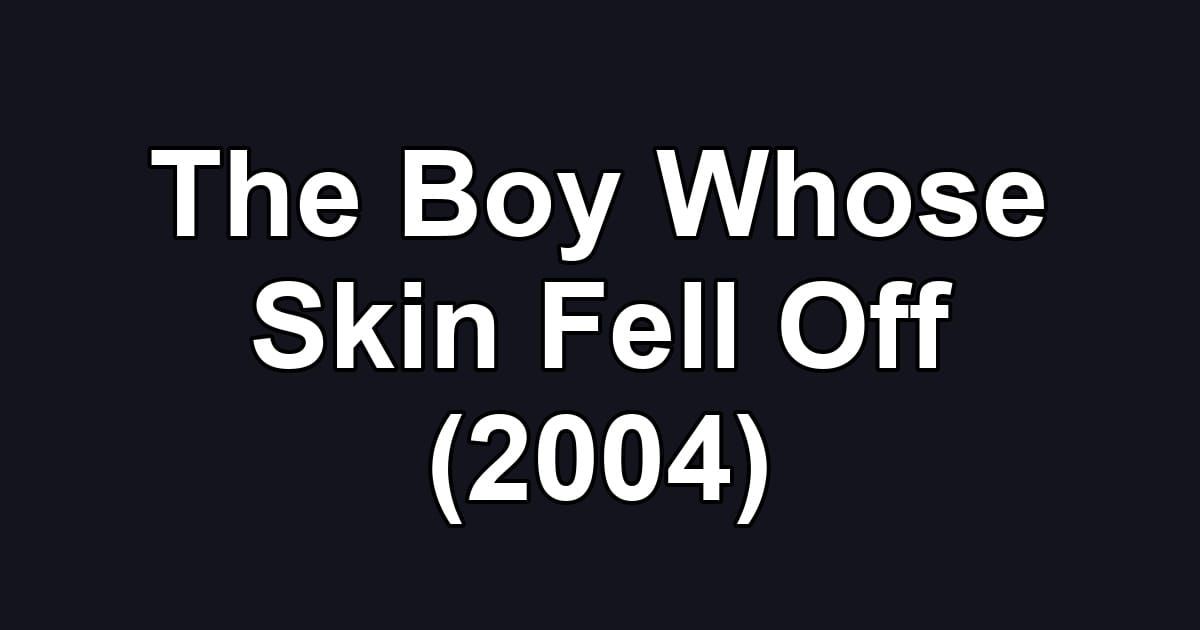 The Boy Whose Skin Fell Off (2004)