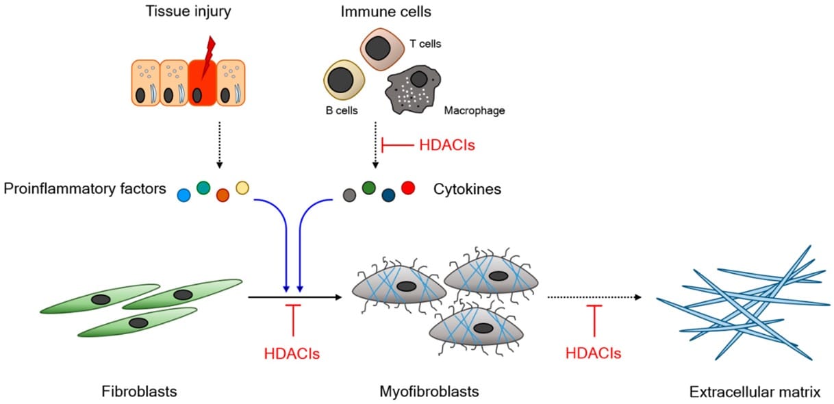 HDAC Inhibitors: Therapeutic Potential in Fibrosis-Associated Human Diseases
