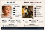 Elimination and Memory: Measles in America, Ebola in Congo, and the Problem of Maintenance