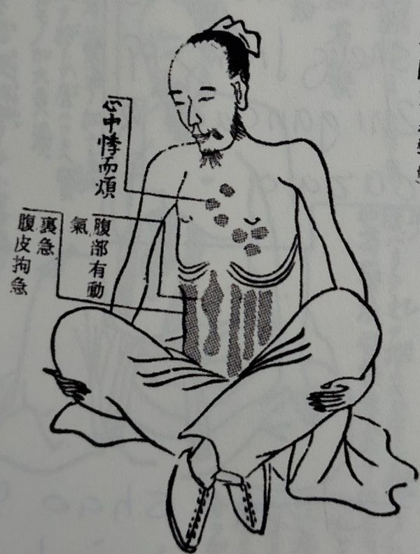 Xiao Jian Zhong Tang