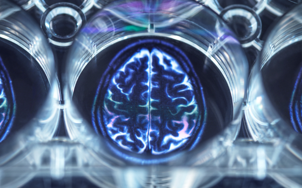 Psychedelics: an investor perspective