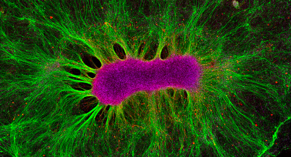 The cerebral organoid enters its industrial era