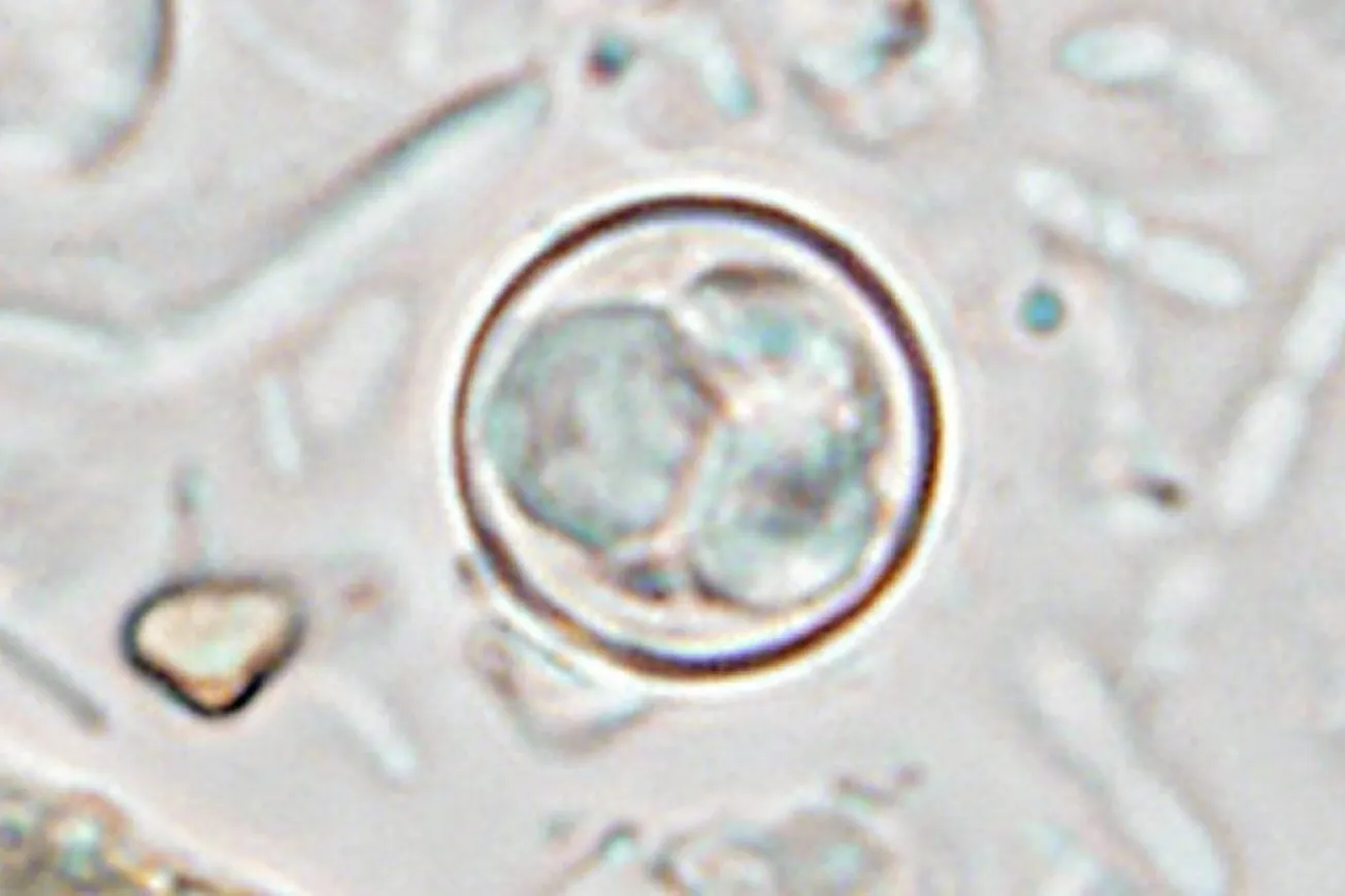 Nine States Report Growing Cyclospora Cases