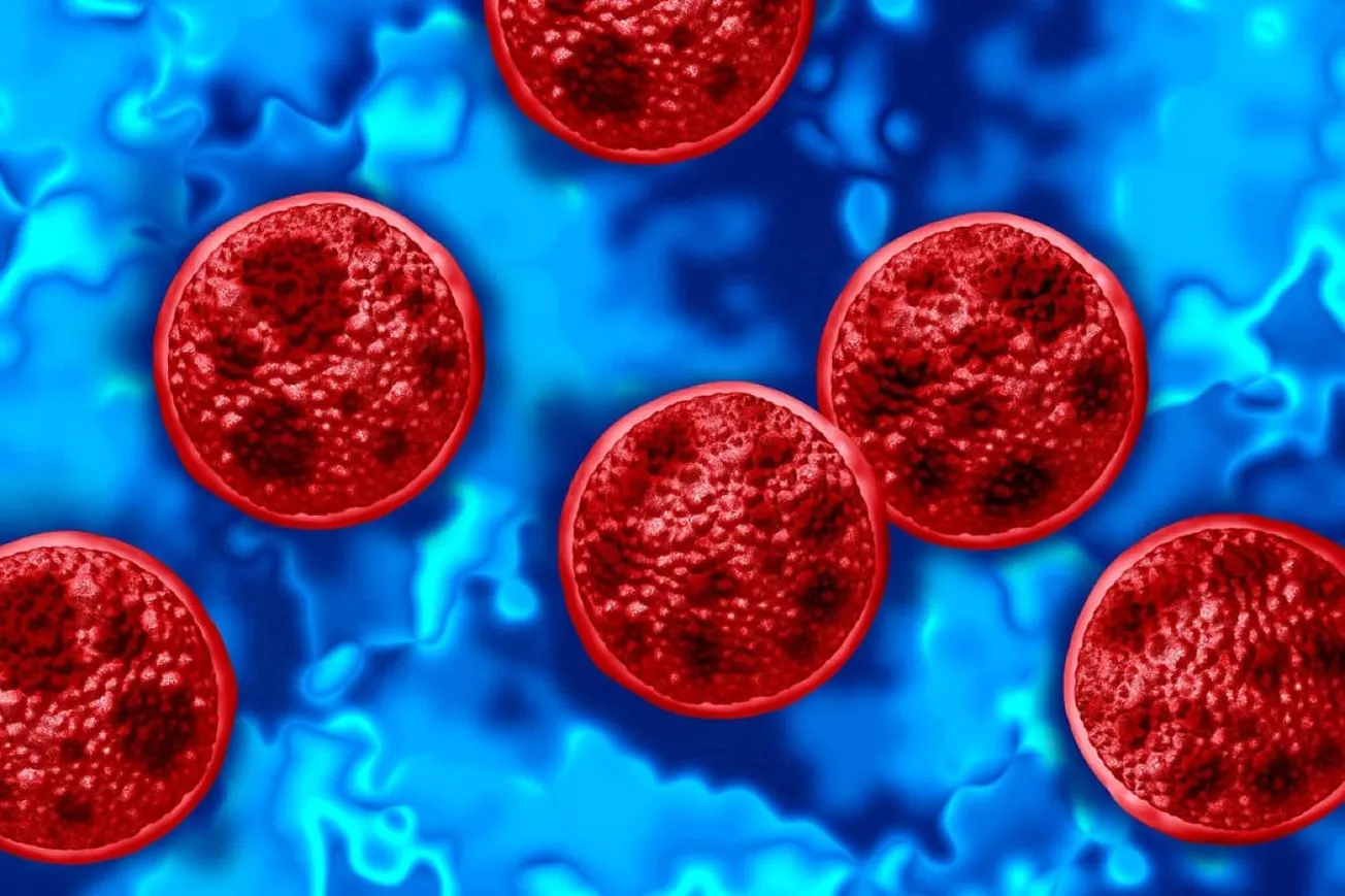 Michigan Battles Largest Cyclosporiasis Outbreak In Nine States