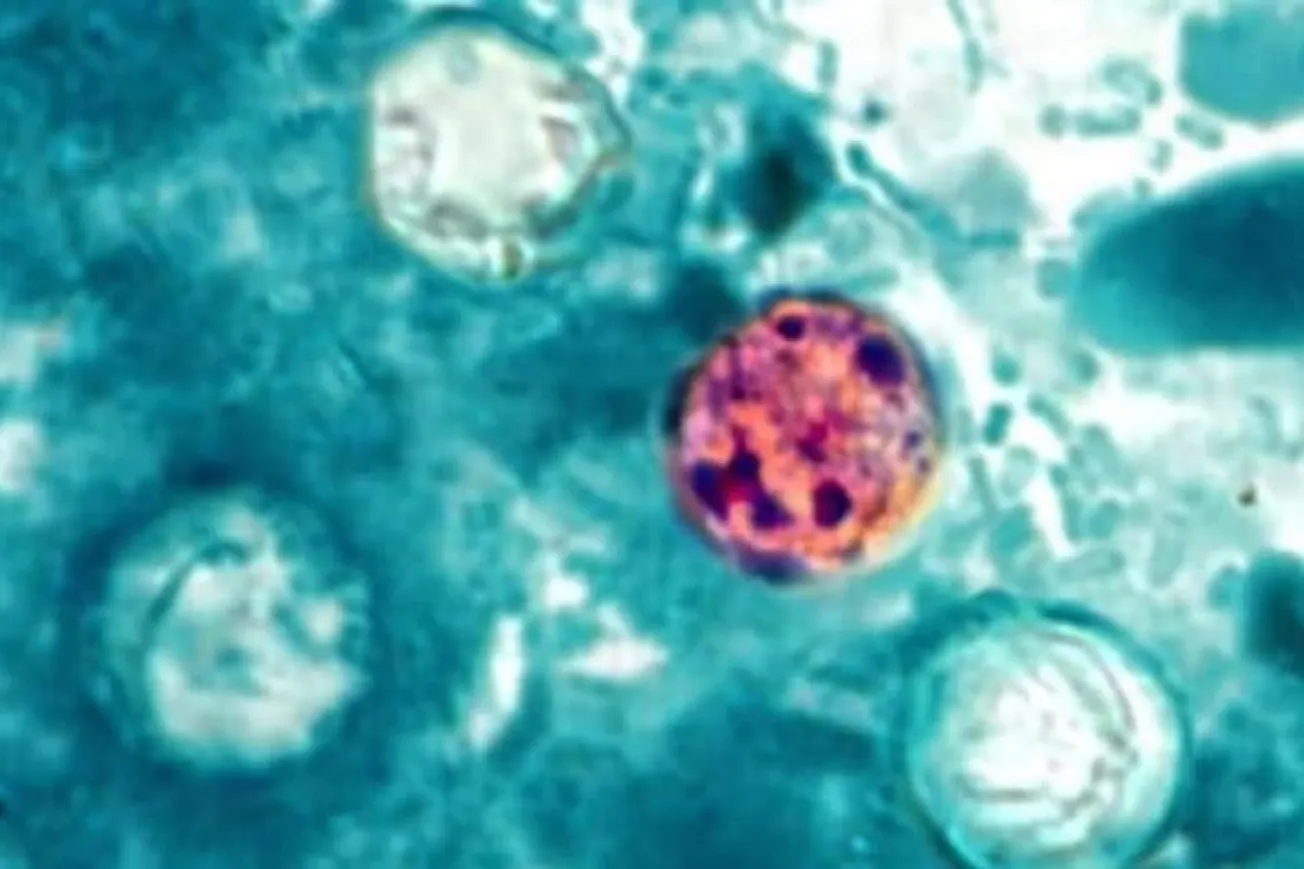 Cyclosporiasis Outbreak Surpasses 1,000 Cases Across The U.S.