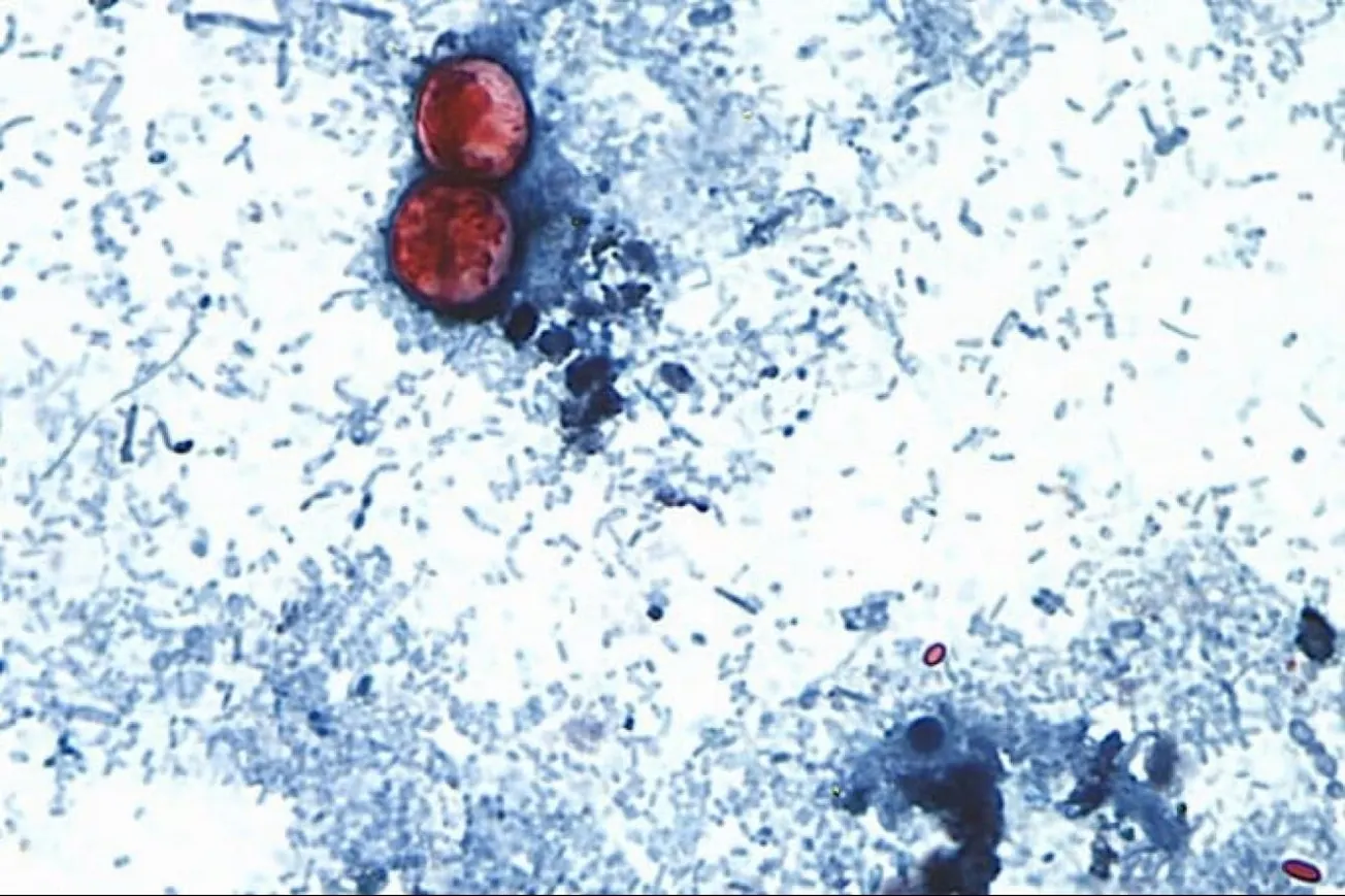 Michigan Reports Two Deaths In Growing Cyclosporiasis Outbreak