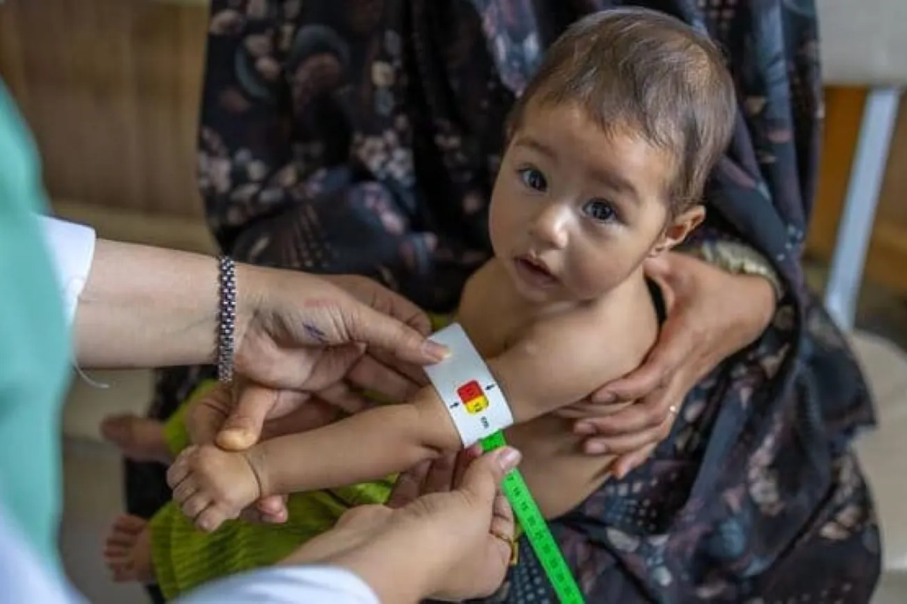 UN Warns Child Malnutrition Crisis Is Worsening In Afghanistan