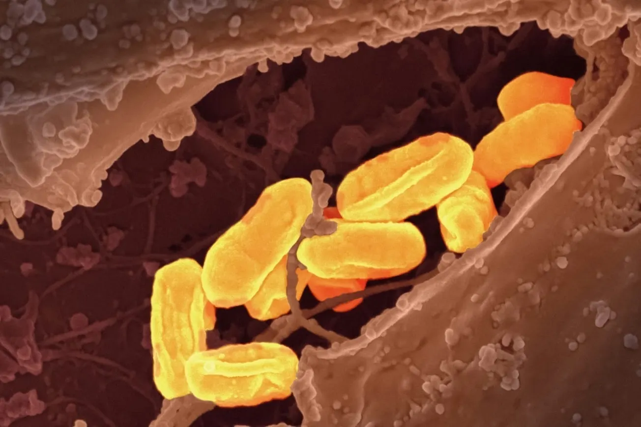 Why Is This Medieval Disease Striking LA County?