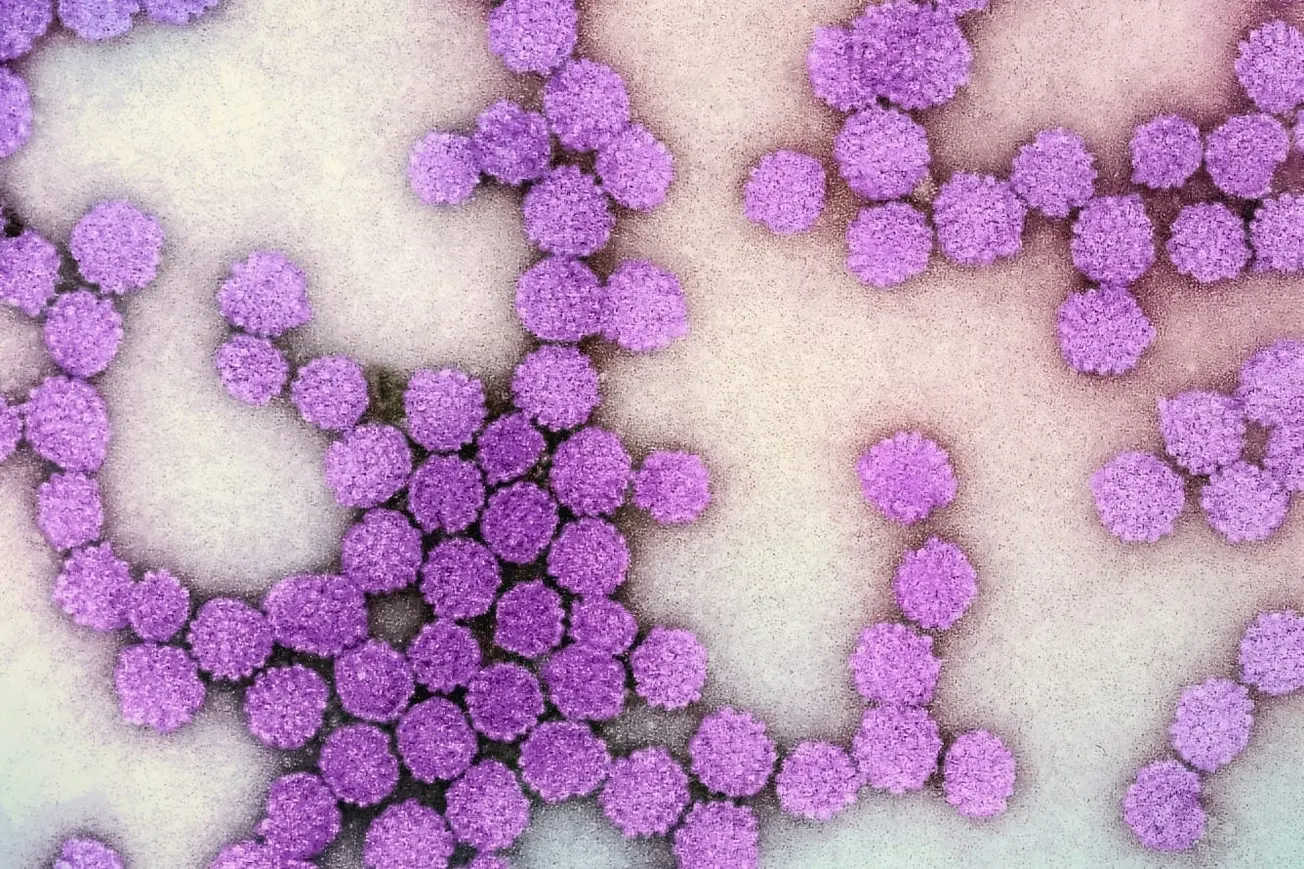 Virginia Navigates Measles Outbreak