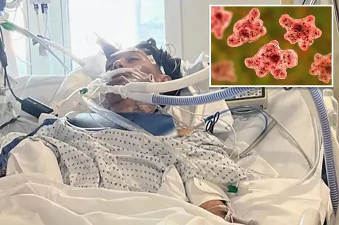 North Carolina Teen Dies After Contracting Rare Brain-Eating Amoeba