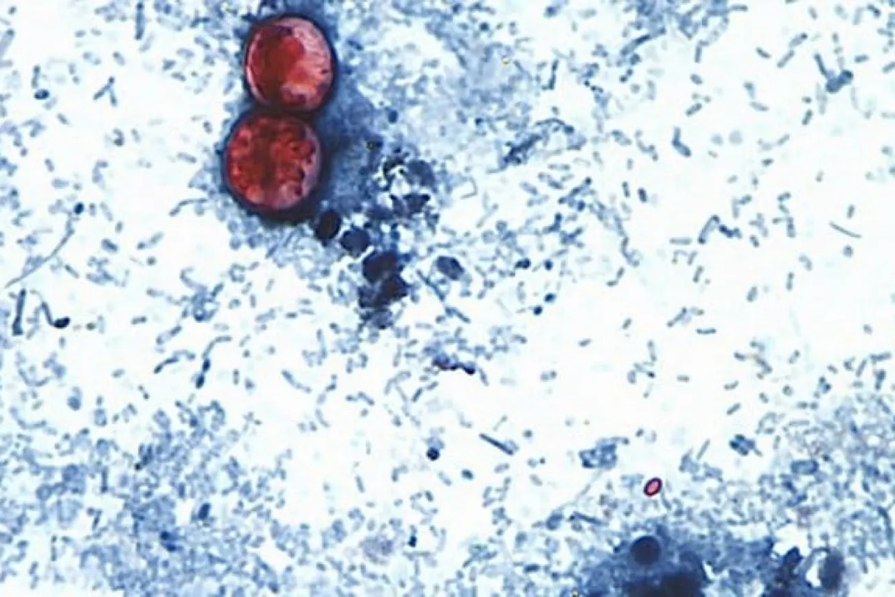 FDA Inspections Declined For Years Before Cyclospora Outbreak, Analysis Finds