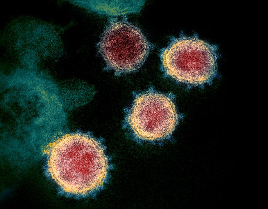 coronavirus model