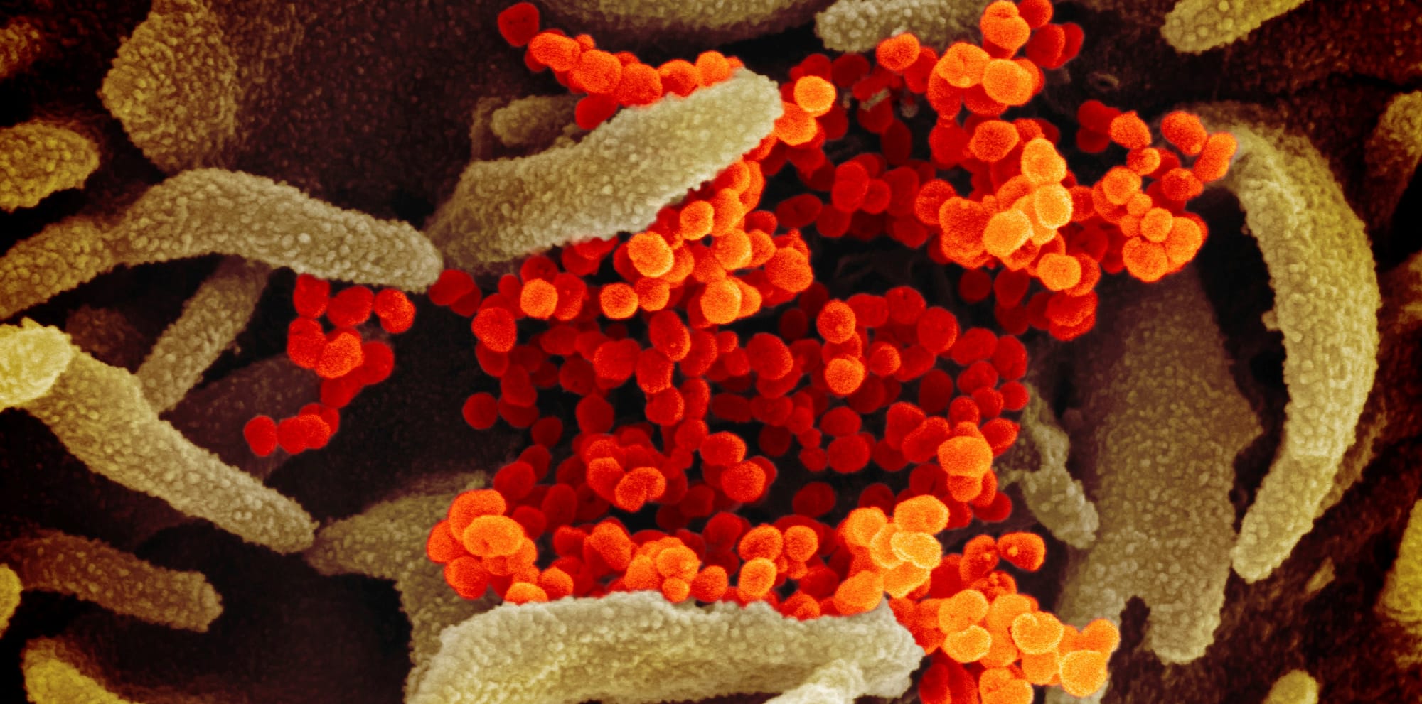 covid microscopic close-up