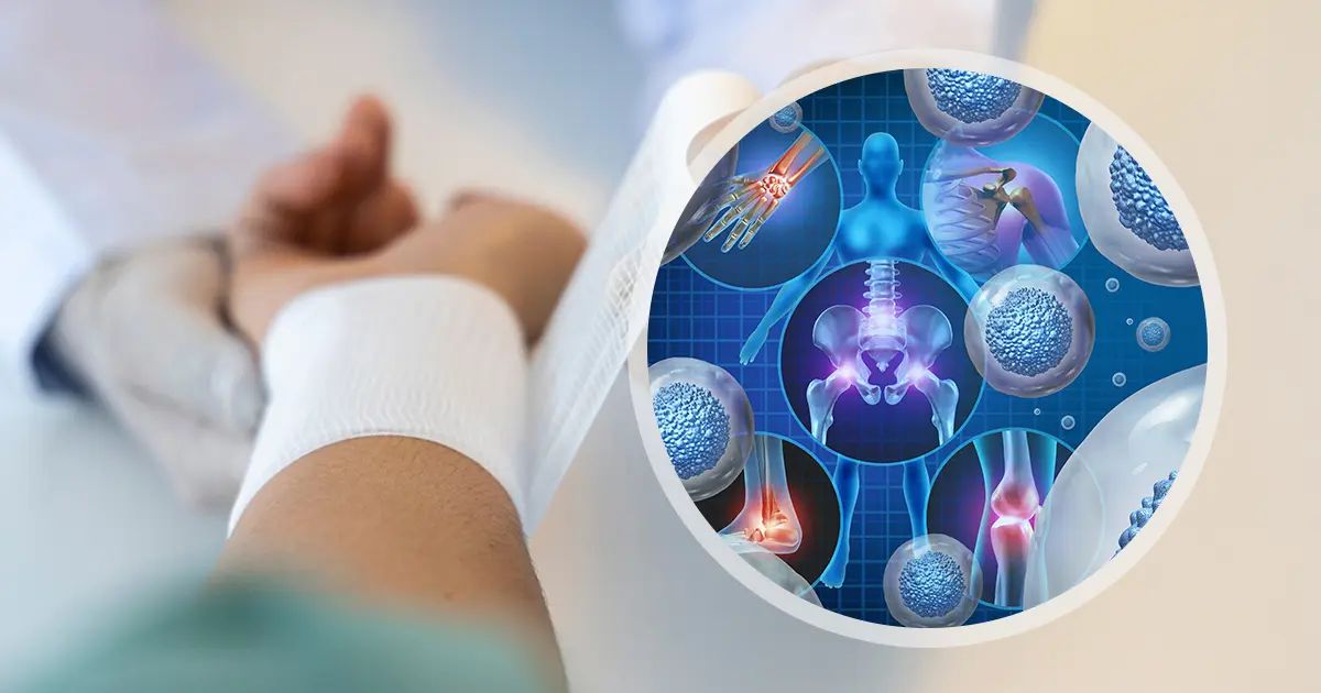 Come le cellule invecchiate aiutano o ostacolano la guarigione