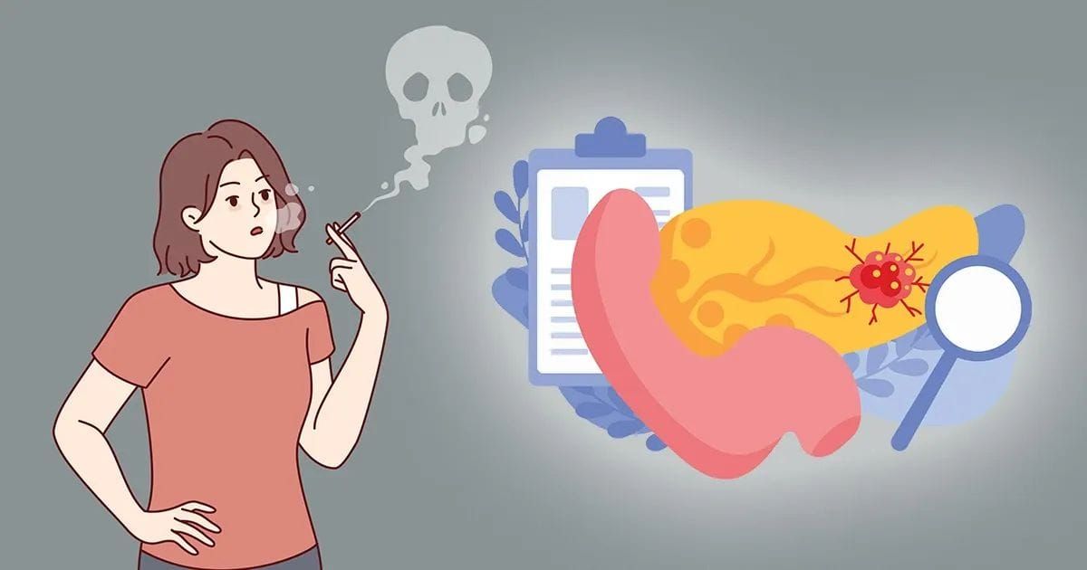 Come il fumo altera il sistema immunitario e favorisce lo sviluppo del cancro al pancreas