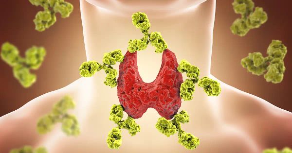La vitamina D rafforza le difese immunitarie contro la tiroidite di Hashimoto