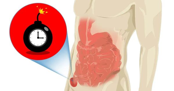 Come sconfiggere le ernie inguinali e ritrovare la tua vitalità