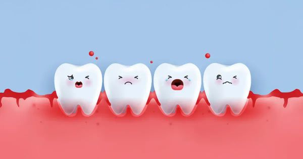 I sintomi della malattia gengivale sono collegati a un rischio più elevato di malattie croniche multiple