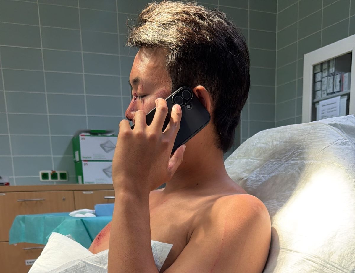 So Your Cyclist Boyfriend Crashed. Congratulations, You’re Part of the Recovery Team Now!