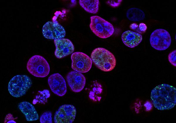 Cell Cloning Milestone