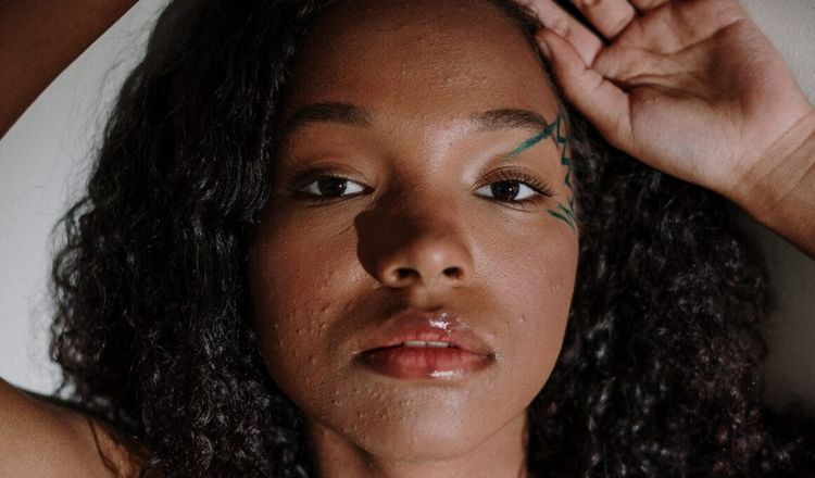 Introducing Acne Club