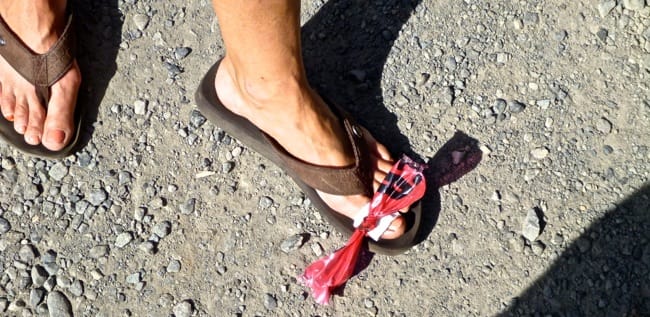 injured