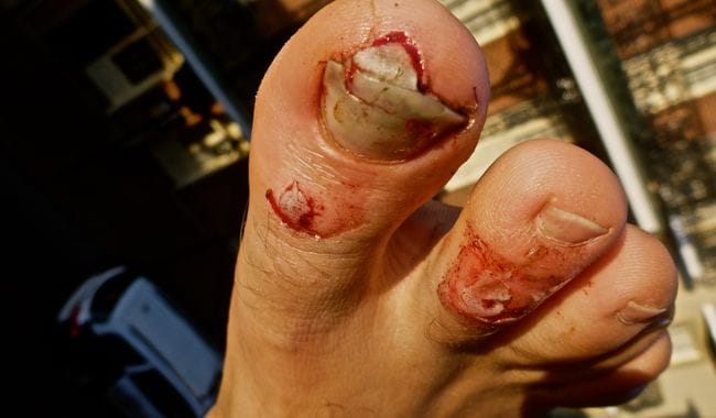 toes