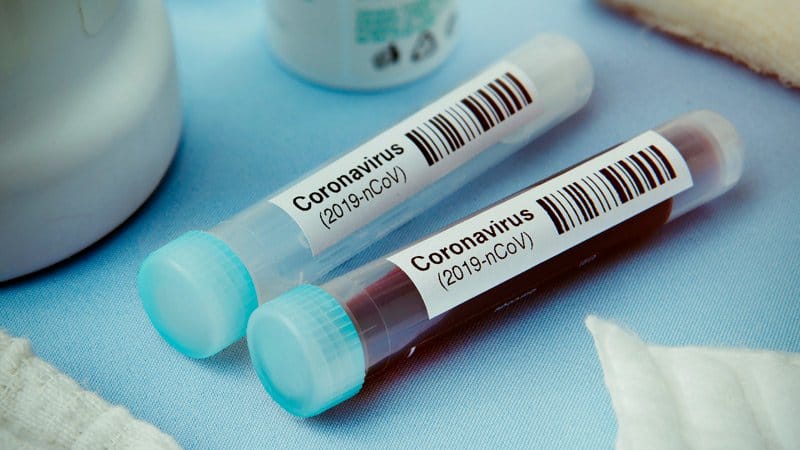 Restrictions to continue after May 11