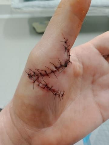 Two surgeries after dog attacks woman and her dog post image