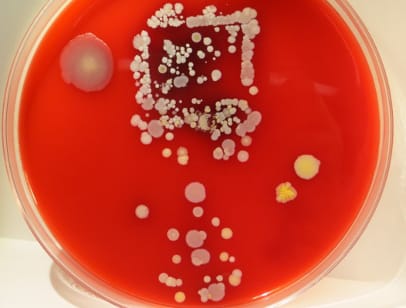 The imprint of a cell phone is clear on this growth medium, which shows how much bacteria was on the surface of a mobile phone used by unit staff at a hospital.