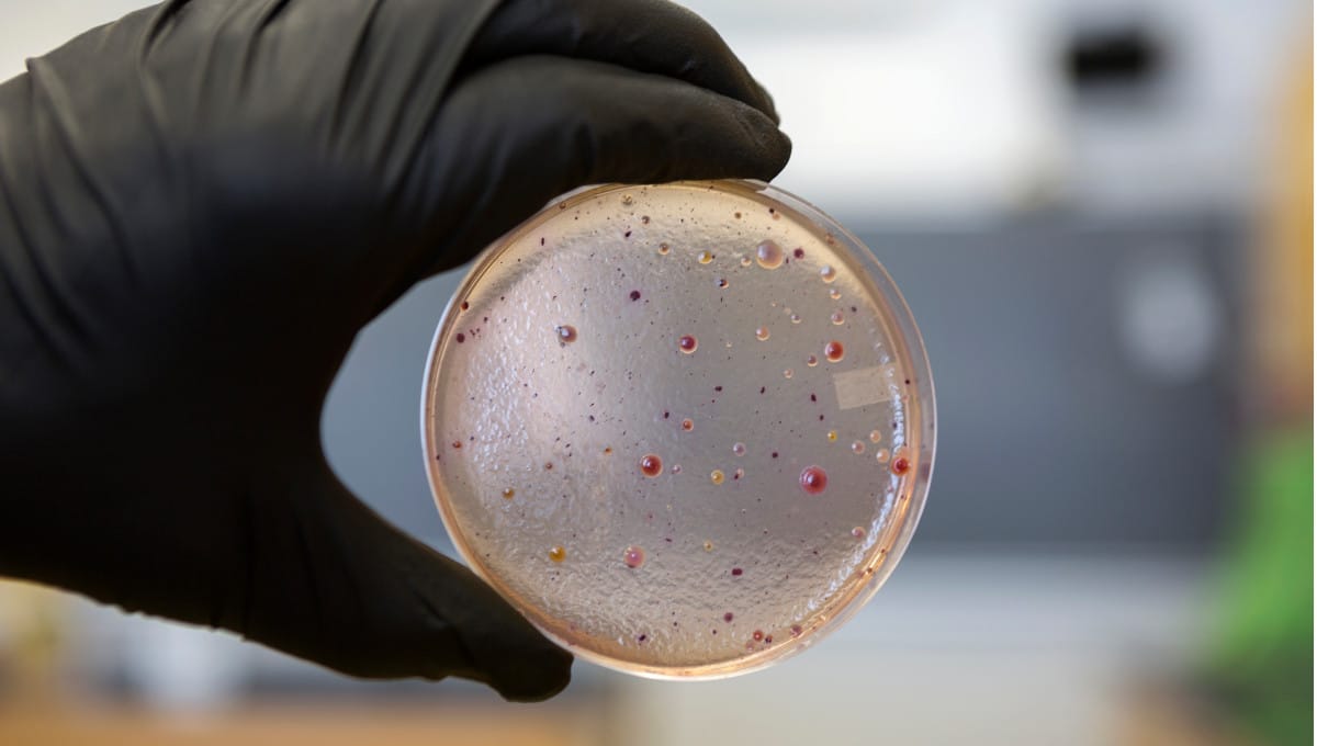 Researchers show pathogen-specific impact of COVID-19 measures